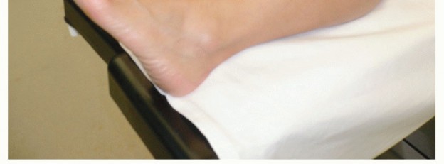 Illustration 5 for Restore Damaged Cartilage with Autologous Chondrocyte Transplantation