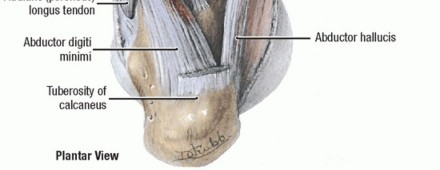Illustration 4 for Restore Your Foot: Surgical Treatment for Hallux MP Joint Turf Toe