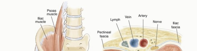Adductor and Iliopsoas Release: End Hip Flexor Contractures