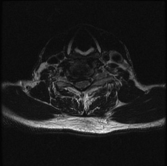 Illustration 25 for Master Orthopedic Spine Cases: Sharpen Your Diagnostic Skills