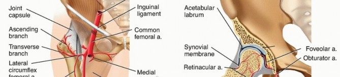 Illustration 6 for Is a Sliding Hip Screw Best for Your Femoral Neck Fracture?