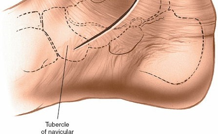 Illustration 26 for Optimized Approaches to the Dorsum of the Foot & Ankle
