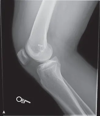 إصابات الملاعب والطب الرياضي: دليل شامل للتشخيص والعلاج مع الأستاذ الدكتور محمد هطيف في صنعاء