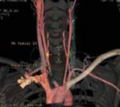 Illustration 7 for Mastering Pediatric Shoulder Fractures: Clinical Insights