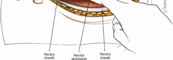 Illustration 62 for Approach to the Lumbar Spine: Mastering Techniques & Anatomy