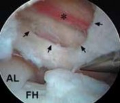 Illustration 16 for J. W. Thomas on Snapping Hip: Causes, Cures & Relief