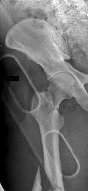 Illustration 109 for OrthoCash: Trauma MCQs & Cases for a yearold woman