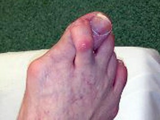 Orthopedic Foot And Ank Review | Dr Hutaif Foot & Ankle -...