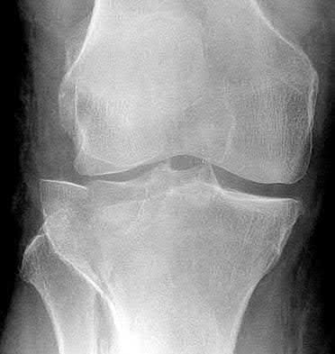 Illustration 24 for OrthoCash: Trauma MCQs & Cases for a yearold woman