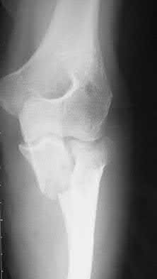 Illustration 31 for OrthoCash: Trauma MCQs & Cases for a yearold woman