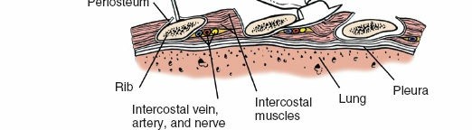Illustration 406 for Approach to the Lumbar Spine: Mastering Techniques & Anatomy
