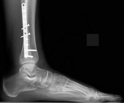 Illustration 63 for OrthoCash: Trauma MCQs & Cases for a yearold woman