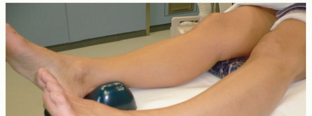 Illustration 4 for Restore Damaged Cartilage with Autologous Chondrocyte Transplantation