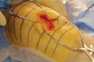 وصف طبي دقيق للمريض