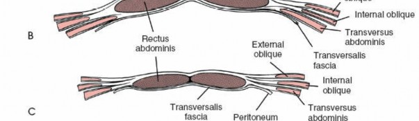 Illustration 110 for Approach to the Lumbar Spine: Mastering Techniques & Anatomy