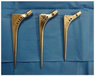 Illustration 14 for Cement in Cement Revision: Simplifying Complex Hip Revisions