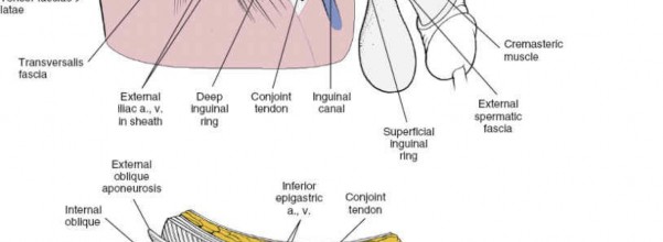 Illustration 17 for Navigating the Anatomy of the Ilioinguinal in Acetabular Surgery