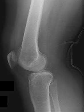 Illustration 165 for OrthoCash: Trauma MCQs & Cases for a yearold woman