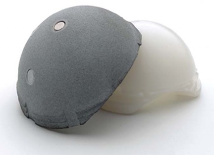 Illustration 5 for Collum Femoris Preserving: Achieve Better Primary Hip Outcomes