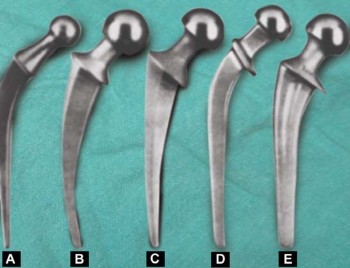Illustration 35 for Mastering Hip Arthroplasty: Its Evolution and Design Unveiled