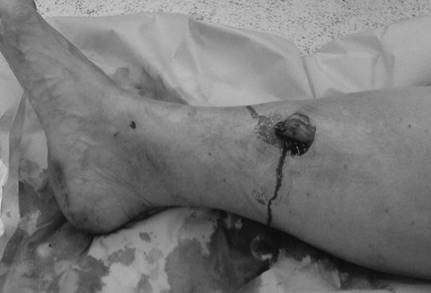 Ace Your FRCS: Key Questions in Trauma & Orthopaedics