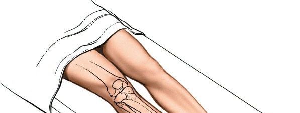 Illustration of tibia anterior approach - Dr. Mohammed Hutaif