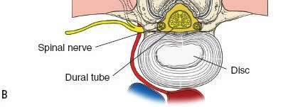 Illustration 12 for Mastering the Spine Posterior Approach: Surgical Essentials