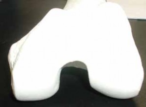 Illustration of femur open reduction - Dr. Mohammed Hutaif