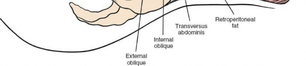 Illustration 33 for Master the Anterolateral Retroperitoneal Approach to Lumbar Spine