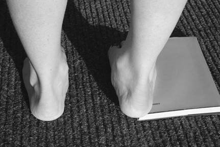 Illustration 6 for Ace FRCS Orthopaedics: Oxford University Press Adult Pathology Viva