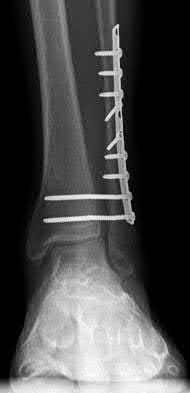 Illustration 62 for OrthoCash: Trauma MCQs & Cases for a yearold woman