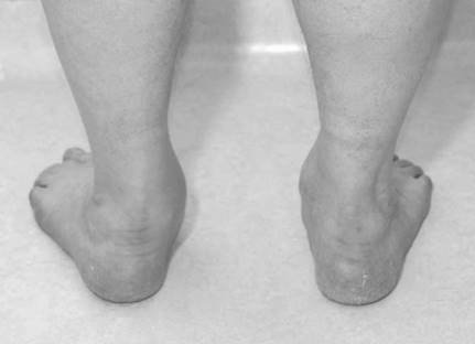 Illustration 2 for Ace FRCS Orthopaedics: Oxford University Press Adult Pathology Viva