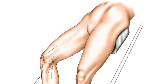 Illustration of proximal tibia posteromedial - Dr. Mohammed Hutaif
