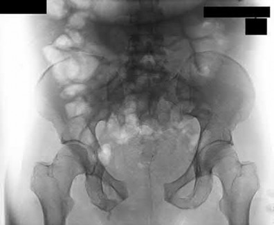 Illustration 145 for OrthoCash: Trauma MCQs & Cases for a yearold woman