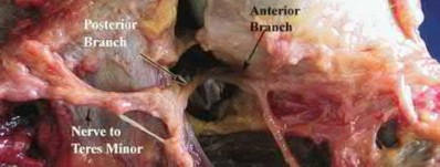 Illustration 81 for OrthoCash: Trauma MCQs & Cases for a yearold woman