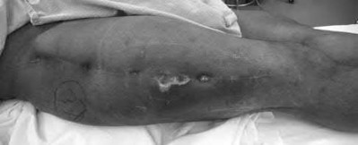 Illustration 201 for OrthoCash: Trauma MCQs & Cases for a yearold woman