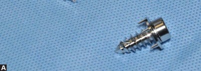 Illustration 14 for Robotics in Total Hip Arthroplasty: A New Era of Precision