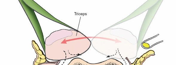 Illustration 54 for Mastering the Approach to the Distal Humerus: Safety & Skills