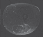 Illustration of br j sports - Dr. Mohammed Hutaif