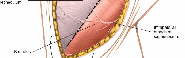 Illustration 68 for Mastering Knee Approaches: Spotlight on Superficial Medial Ligament