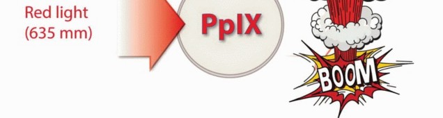 Illustration 6 for Targeted Ablation of Musculoskeletal Tumors: A Safer Approach