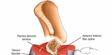 Illustration 30 for Key Approaches for External Fixation: Humerus, Radius, Ulna, Wrist