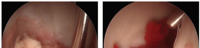 Illustration 8 for Hip Pain Relief: Arthroscopy for Nonstructural Pathology