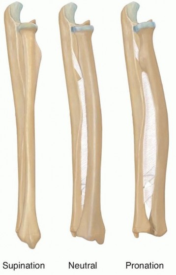 Corrective Osteotomy for Radius: End Pain, Restore Function