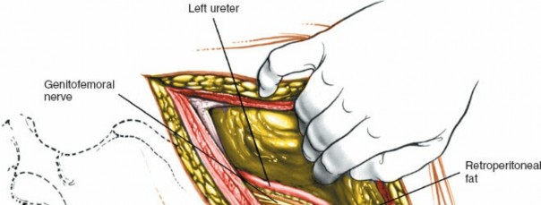 Illustration 146 for Approach to the Lumbar Spine: Mastering Techniques & Anatomy