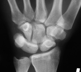 Illustration 3 for Wrist Recovery Guide: Mastering Degrees with Forearm Movement