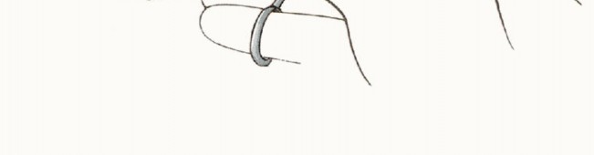 Illustration 25 for Anterior Flap Hemipelvectomy: Leveraging fig tech fig for Difficult Tumors