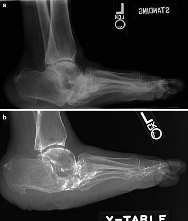 Illustration 123 for First Metatarsal Surgery: Expert Solutions for Foot & Ankle Pain
