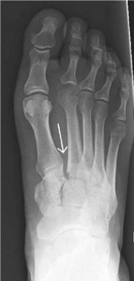 Illustration 3 for Ace Your FRCS: Key Questions in Trauma & Orthopaedics