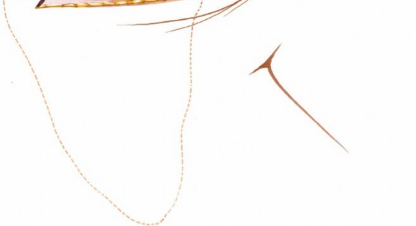 Illustration 169 for Essential Guide: Mastering Every Approach to the Shoulder